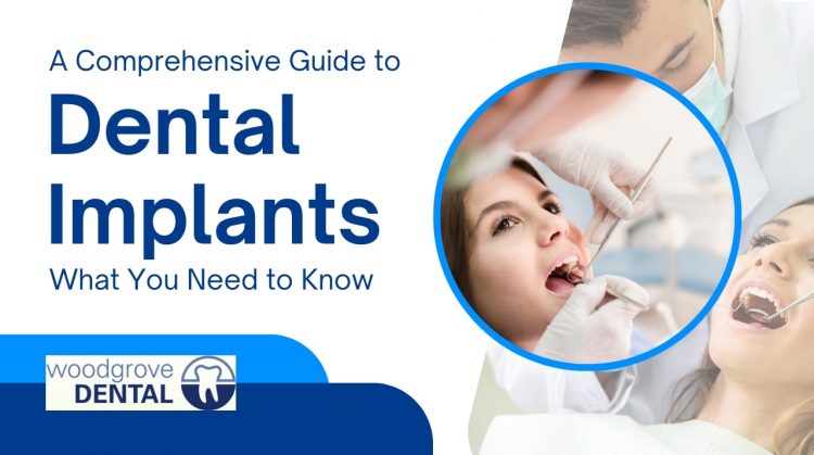 Dental Implants