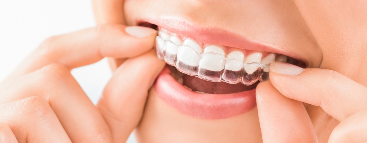 Find the Best Dentist in Melton